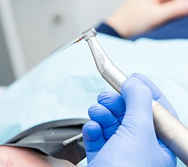 歯内療法・根管治療